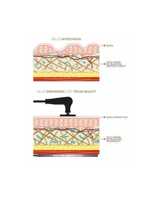 Globus RF Beauty 6000 MED re as it acts